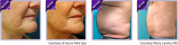 special_before&after (1)