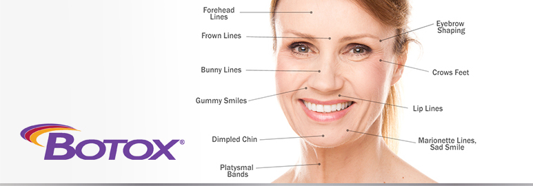 botox treatment in downtown scottsdale