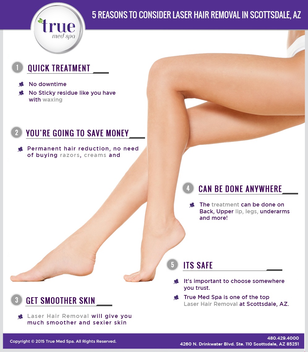 infographic